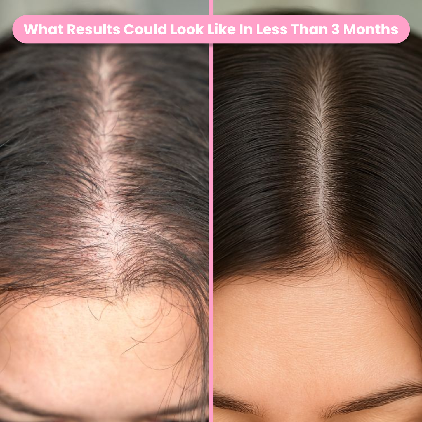 Natural Hair Vitamin Gummies x2