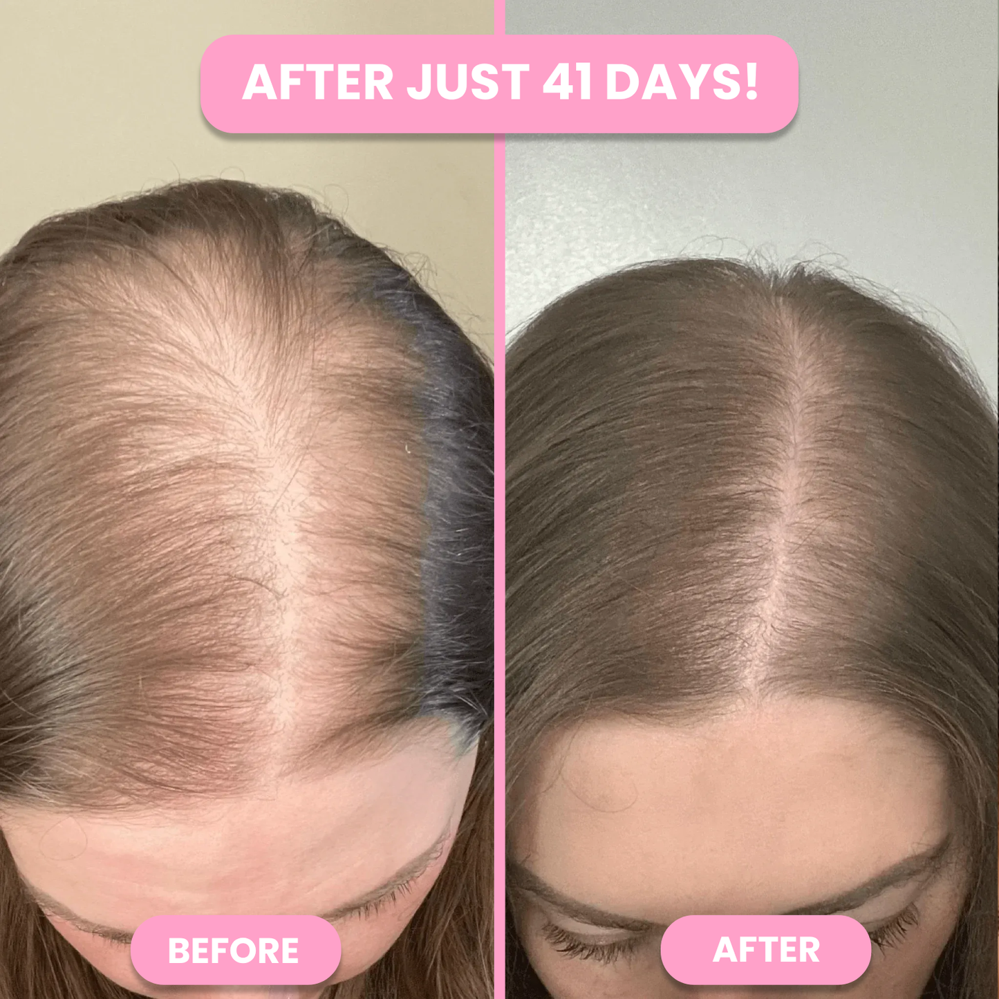 Natural Hair Vitamin Gummies x2